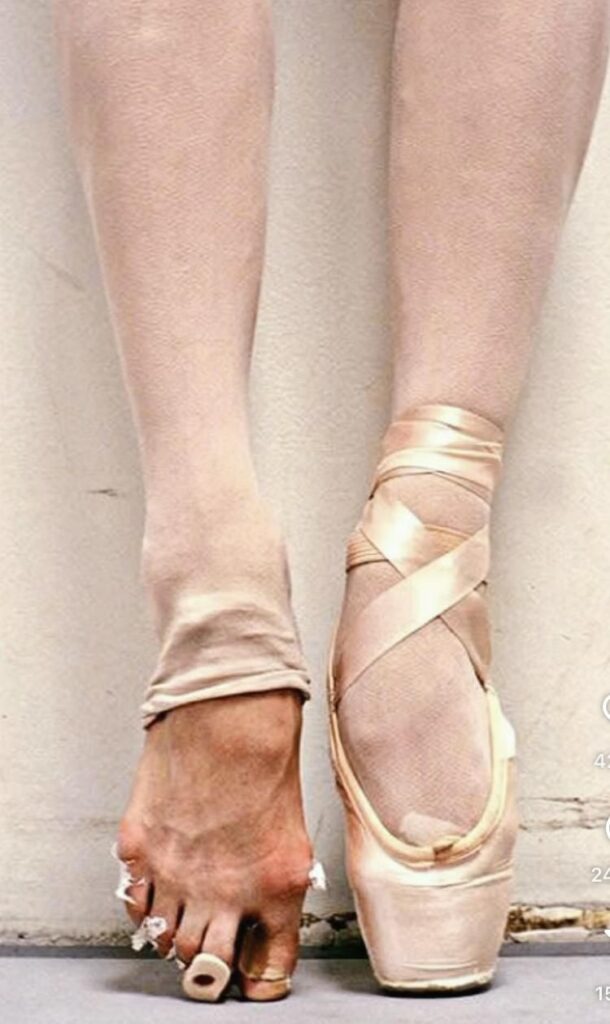 Foto bailarina pés arnaldo rego